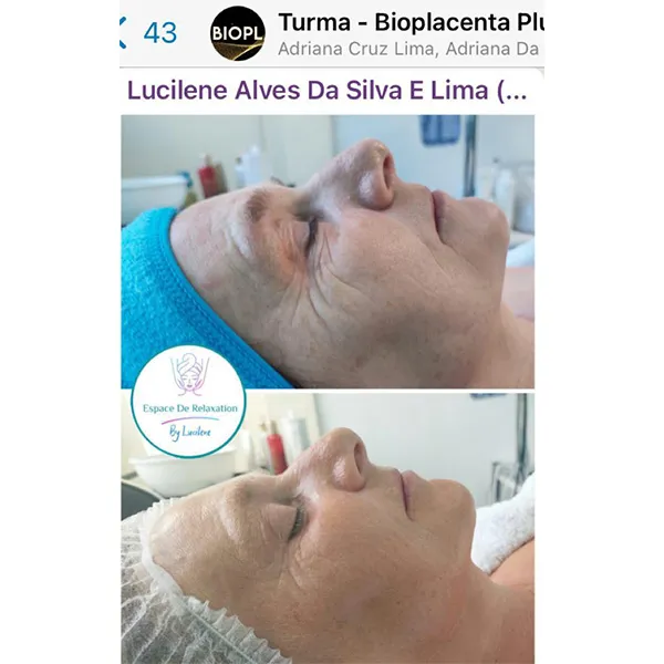 IMG-DEP-BIOPLACENTA-01-_0000_WhatsApp Image 2022-09-22 at 10.20.15