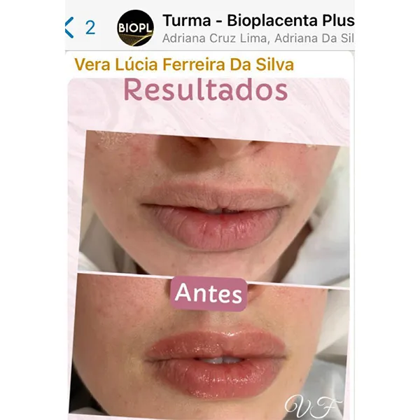 IMG-DEP-BIOPLACENTA-01-_0001_WhatsApp Image 2022-09-20 at 20.22.32