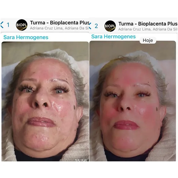 IMG-DEP-BIOPLACENTA-01-_0003_WhatsApp Image 2022-09-20 at 16.04.42